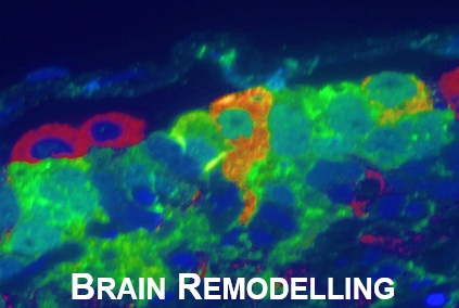 The role of neuro-epithelial-like and radial-glial stem and progenitor cells in development, plasticity, and repair