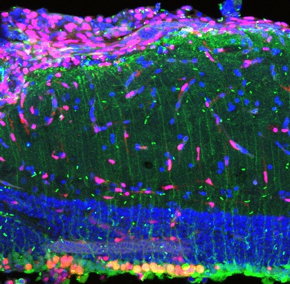 3dpl GFP PCNA DAPI
