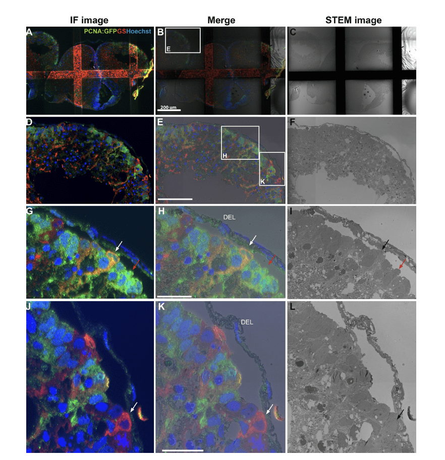 TEM, SEM, and STEM‑based immuno‑CLEM workflows offer complementary advantages